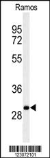 Anti-C19orf18 Rabbit Polyclonal Antibody