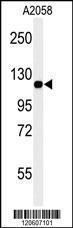 Anti-MCAM Rabbit Polyclonal Antibody (FITC (Fluorescein Isothiocyanate))