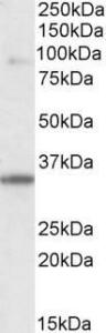 Anti-LDB3 Antibody (A84127) (0.1 µg/ml) staining of Human Skeletal Muscle lysate (35 µg protein in RIPA buffer). Primary incubation was 1 hour. Detected by chemilu minescence