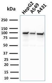 Anti-MSH2 Mouse Monoclonal Antibody [clone: MSH2/2622]