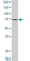 Anti-PRKCH Mouse Polyclonal Antibody