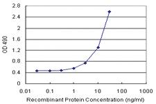 Anti-IRF3 Polyclonal Antibody Pair