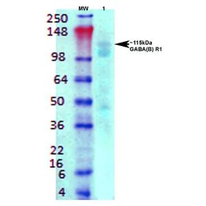 Western blot analysis of rat brain membrane lysate showing detection of GABA B Receptor 1 protein using Anti-GABA B Receptor 1 Antibody [S93A-49] (A304759) at 1:1,000