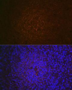 Anti-CD21 antibody