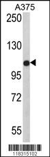 Anti-PALA Rabbit Polyclonal Antibody