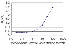 Anti-TYMS Polyclonal Antibody Pair