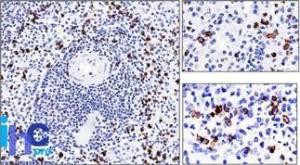 Immunohistochemical analysis of formalin-fixed, paraffin-embedded human spleen using Anti-CD57 Antibody [NK-1]