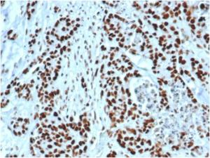 Immunohistochemical analysis of formalin-fixed, paraffin-embedded human colon using Anti-MSH2 Antibody [MSH2/6549R]