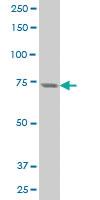 Anti-PRKCH Mouse Polyclonal Antibody