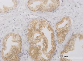 Anti-RIPK2 Mouse Monoclonal Antibody [clone: 6F7]