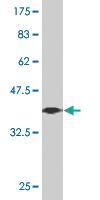 Anti-ZNF213 Mouse Monoclonal Antibody [clone: 3E7]