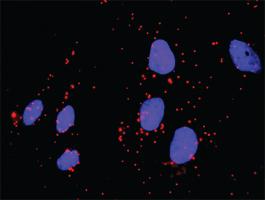 Anti-SYK Antibody Pair