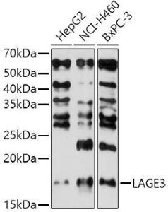 Western blot analysis of extracts of various cell lines, using Anti-LAGE3 Antibody (A307685) at 1:1000 dilution