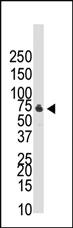 Anti-BMPR1B Rabbit Polyclonal Antibody