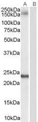 Anti-GOLGA3 Antibody (A84128) (0.1 µg/ml) staining of Hela lysate (35 µg protein in RIPA buffer). Primary incubation was 1 hour. Detected by chemilu minescence