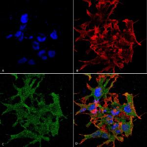 Immunocytochemistry/Immunofluorescence analysis of human neuroblastoma cell line (SK-N-BE, fixed in 4% formaldehyde for 15 min at room temperature, using Anti-GABA B Receptor 1 Antibody [S93A-49] (A304759), at 1:100 for 60 minutes at room temperature