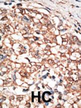 Anti-BMPR1B Rabbit Polyclonal Antibody