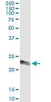 Anti-RRAS Antibody Pair