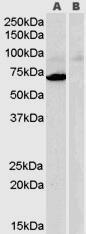 Anti-MAOA antibody