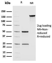 Anti-MSH2 Mouse Monoclonal Antibody [clone: MSH2/2622]