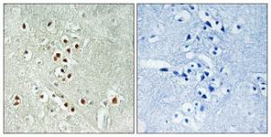 Immunohistochemical analysis of paraffin-embedded human brain using Anti-GADD45GIP1 Antibody. The right hand panel represents a negative control, where the antibody was pre-incubated with the immunising peptide.