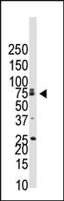 Anti-BMPR1B Rabbit Polyclonal Antibody