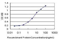 Anti-RIPK2 Mouse Monoclonal Antibody [clone: 6F7]