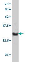 Anti-NKIRAS1 Mouse Monoclonal Antibody [clone: 2A7]