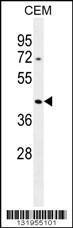 Anti-POTEKP Rabbit Polyclonal Antibody (Biotin)