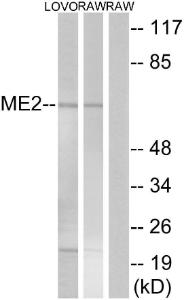 Anti-ME2 antibody