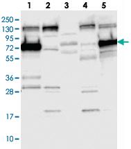 Anti-SYTL1 Rabbit Polyclonal Antibody