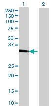 Anti-CA10 Mouse Polyclonal Antibody