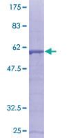 Human recombinant SDCBP