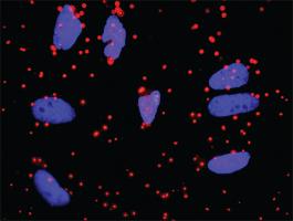 Anti-APOA1 + FGA Antibody Pair