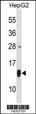 Anti-HSPE1 Rabbit Polyclonal Antibody (FITC (Fluorescein Isothiocyanate))