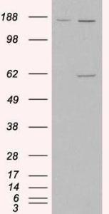 Anti-MAOA antibody