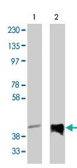 Anti-PPAP2C Rabbit Polyclonal Antibody