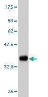 Anti-FGR Mouse Monoclonal Antibody [clone: 3G10]