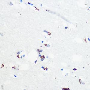 Immunohistochemistry analysis of paraffin-embedded human brain tissue using Anti-Tau (phospho Ser416) Antibody (A308895) at a dilution of 1:100 (40X lens). Perform microwave antigen retrieval with 10 mM Tris/EDTA buffer pH 9.0 before commencing with IHC staining protocol