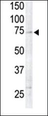 Anti-RPS6KA6 Rabbit Polyclonal Antibody