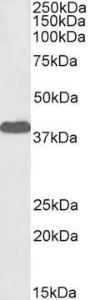 Anti-EPM2A Antibody (A82630 / Biotin) (1 µg/ml) staining of Human Cerebellum lysate (35 µg protein in RIPA buffer), exactly mirroring its parental non-biotinylated product