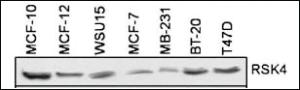 Anti-RPS6KA6 Rabbit Polyclonal Antibody