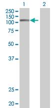 Anti-TCEB3 Mouse Polyclonal Antibody