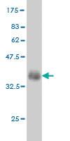 Anti-FGR Mouse Monoclonal Antibody [clone: 3B11]