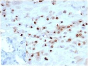 Immunohistochemical analysis of formalin-fixed, paraffin-embedded human placenta using Anti-p57 Kip2 Antibody [KIP2/7083R] at 2 µg/ml in PBS for 30 minutes at room temperature. Inset: PBS instead of the primary antibody. Secondary antibody negative control