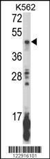 Anti-KIR2DL5B Rabbit Polyclonal Antibody (AP (Alkaline Phosphatase))