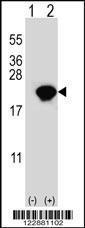 Anti-PIN1 Rabbit Polyclonal Antibody (FITC (Fluorescein Isothiocyanate))