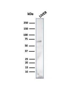 Western blot analysis of human liver tissue lysate using Anti-Albumin Antibody [ALB/2141]