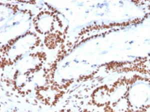 Anti-MSH2 Mouse Monoclonal Antibody [clone: MSH2/2622]