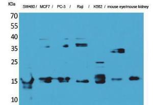 Western blot analysis of SW480, MCF7, PC 3, Raji, K56 mouse eye, mouse kidney cells using Anti-MDK Antibody